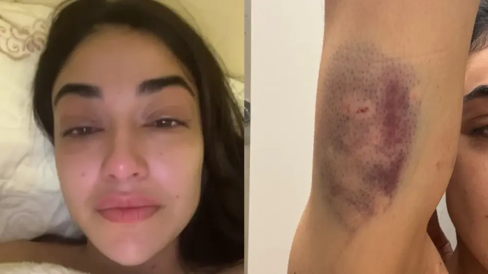 Justiça concede medida protetiva a empresária agredida pelo namorado em Nova Lima