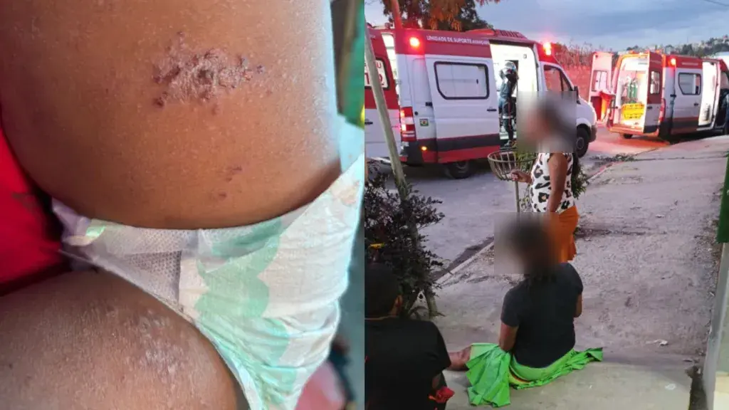 Bebê indígena Warao morre de desnutrição em Betim após 8 dias sem comer ou beber