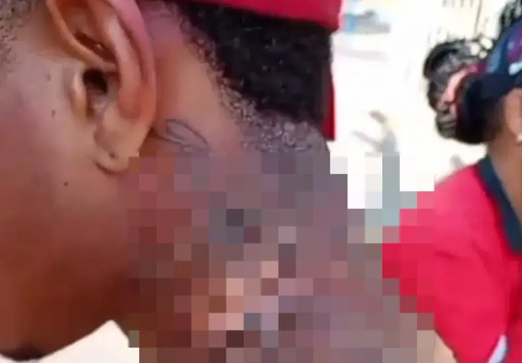 Mulher agride companheiro com socos, mordidas e água fervendo no João XXIII em Itabira