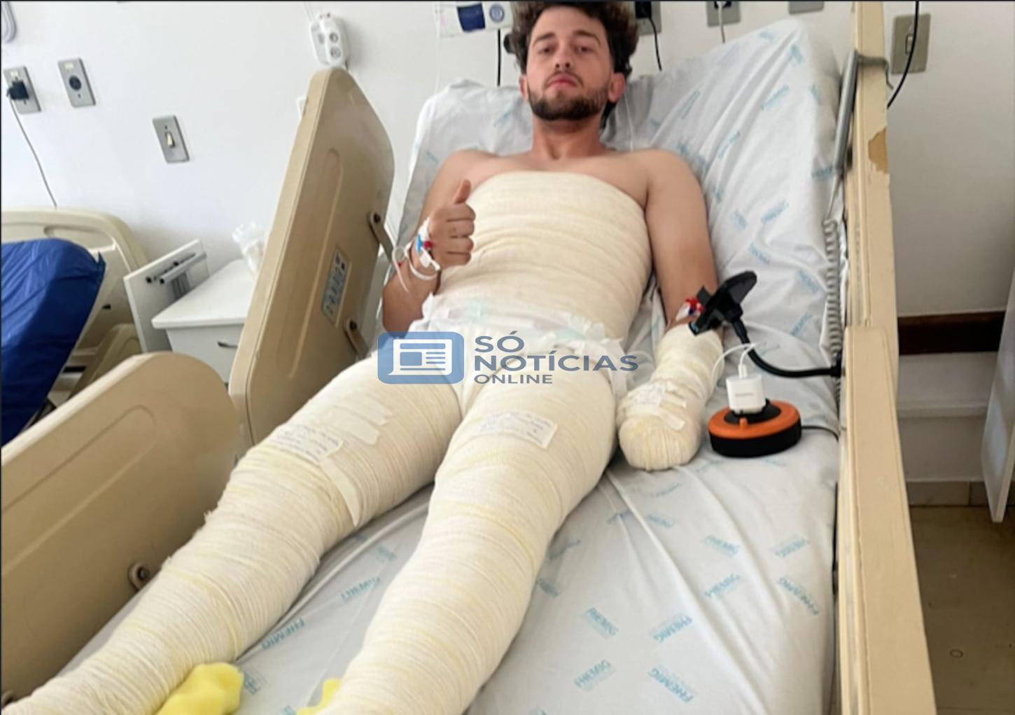 Jovem sofre queimaduras graves após amigo incendiar barraca em confraternização em Lagamar; família questiona investigação